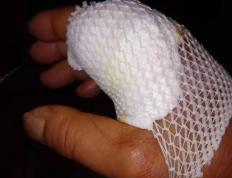 开云体育APP下载-福建泉州队员因伤退出球队，伤情严重